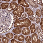 Anti-NDUFAF1 Antibody
