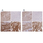 Immunohistochemical staining of human heart muscle, liver, prostate and skeletal muscle using Anti-SYNM antibody HPA040066 (A) shows similar protein distribution across tissues to independent antibody HPA044200 (B).