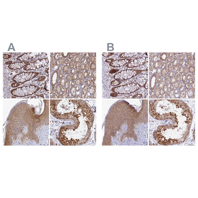 Anti-WDR61 Antibody