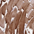 Immunohistochemical staining of human skeletal muscle shows strong cytoplasmic positivity in myocytes.