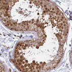 Immunohistochemical staining of human testis shows moderate nuclear positivity in cells in seminiferous ducts.