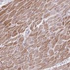 Immunohistochemical staining of human heart muscle shows strong cytoplasmic positivity in cardiomyocytes.