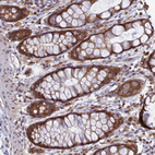 Immunohistochemical staining of human rectum shows moderate cytoplasmic positivity in glandular cells.