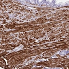 Immunohistochemical staining of human prostate shows strong cytoplasmic positivity in smooth muscle cells.
