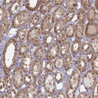 Immunohistochemical staining of human kidney shows moderate cytoplasmic positivity in cells in tubules.