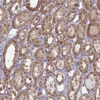 Immunohistochemical staining of human kidney shows moderate cytoplasmic positivity in cells in tubules.