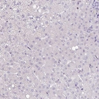 Immunohistochemical staining of human liver shows no cytoplasmic positivity in hepatocytes.