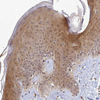 Immunohistochemical staining of human skin shows moderate cytoplasmic positivity in squamous epithelial cells.
