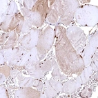 Anti-RSRC2 Antibody
