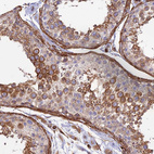 Anti-MYO9A Antibody