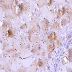 Anti-GAPDH Antibody