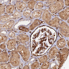 Immunohistochemical staining of human kidney shows strong cytoplasmic positivity in cells in glomeruli.