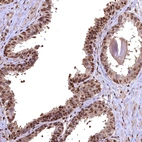 Immunohistochemical staining of human prostate shows moderate to strong nuclear and cytoplasmic positivity in glandular cells.