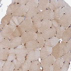 Immunohistochemical staining of human skeletal muscle shows moderate cytoplasmic positivity in myocytes.