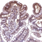 Immunohistochemical staining of human gastrointestinal shows moderate nuclear and cytoplasmic positivity in glandular cells.