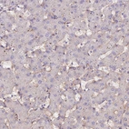 Immunohistochemical staining of human liver shows no positivity in hepatocytes as expected.