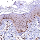 Immunohistochemical staining of human skin shows moderate to strong nuclear positivity in squamous epithelial cells.