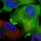 Immunofluorescent staining of human cell line U-251 MG shows localization to plasma membrane & cytosol.