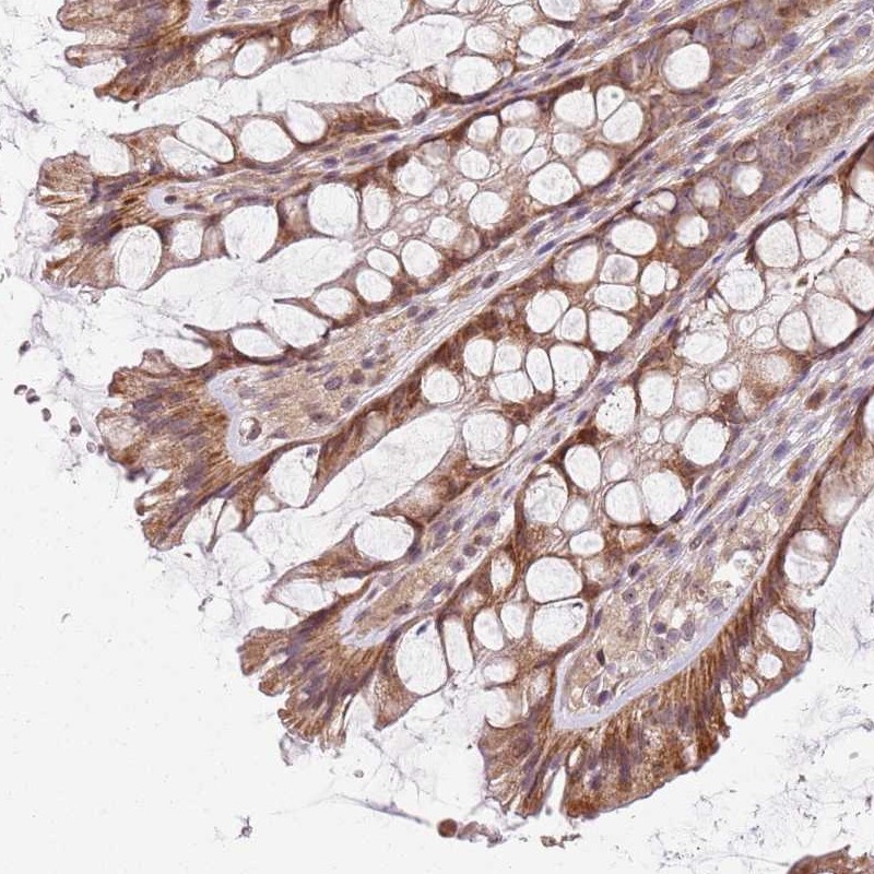 Anti-CHURC1 Antibody
