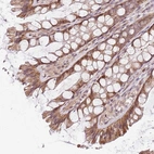 Anti-CHURC1 Antibody