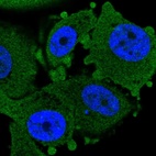 Immunofluorescent staining of human cell line PC-3 shows localization to cytosol.