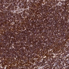 Anti-AAAS Antibody