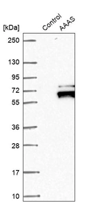 Western blot analysis in control (vector only transfected HEK293T lysate) and AAAS over-expression lysate (Co-expressed with a C-terminal myc-DDK tag (~3.1 kDa) in mammalian HEK293T cells, LY402460).
