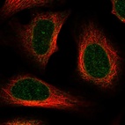 Anti-AAAS Antibody