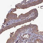 Immunohistochemical staining of human fallopian tube shows moderate to strong cytoplasmic positivity in glandular cells.