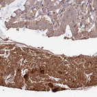 Immunohistochemical staining of human colon shows moderate to strong cytoplasmic positivity in smooth muscle cells.