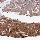 Immunohistochemical staining of human colon shows moderate to strong cytoplasmic positivity in smooth muscle cells.
