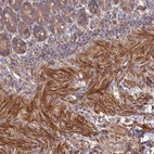 Immunohistochemical staining of human duodenum shows moderate to strong cytoplasmic positivity in smooth muscle cells.