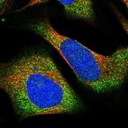 Immunofluorescent staining of human cell line U-2 OS shows localization to cytosol.