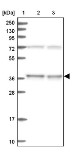 Lane 1: Marker [kDa] 250, 130, 95, 72, 55, 36, 28, 17, 10_br/_Lane 2: Human cell line RT-4_br/_Lane 3: Human cell line U-251MG sp