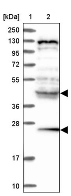 Lane 1: Marker [kDa] 250, 130, 95, 72, 55, 36, 28, 17, 10_br/_Lane 2: Human cell line RT-4