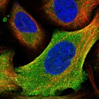 Immunofluorescent staining of human cell line U-2 OS shows localization to plasma membrane & cytosol.