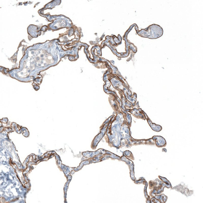 Anti-AGRN Antibody