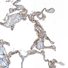 Anti-AGRN Antibody
