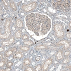 Immunohistochemical staining of human kidney shows weak membranous positivity in cells in glomeruli.