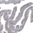 Immunohistochemical staining of human Fallopian tube shows moderate positivity in basement membrane in glandular cells.