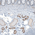 Immunohistochemical staining of human colon shows strong membranous positivity in endothelial cells.