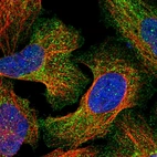 Immunofluorescent staining of human cell line U-2 OS shows localization to plasma membrane & cytosol.