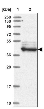 Lane 1: Marker [kDa] 250, 130, 95, 72, 55, 36, 28, 17, 10_br/_Lane 2: Human cell line RT-4