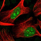 Immunofluorescent staining of human cell line U-2 OS shows localization to nucleus & nucleoli.
