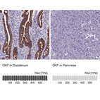 Anti-OAT Antibody