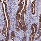 Immunohistochemical staining of human duodenum shows strong granular cytoplasmic positivity in glandular cells.
