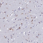 Immunohistochemical staining of human cerebral cortex shows moderate to strong granular cytoplasmic positivity in neurons.