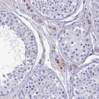 Immunohistochemical staining of human testis shows moderate granular cytoplasmic positivity in Leydig cells.