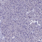 Immunohistochemical staining of human pancreas shows no positivity in exocrine glandular cells as expected.