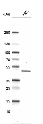 Western blot analysis in human cell line HEL.